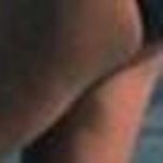 Asthma