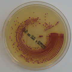ESBL-producing E. coli and Klebsiella infections increasing
