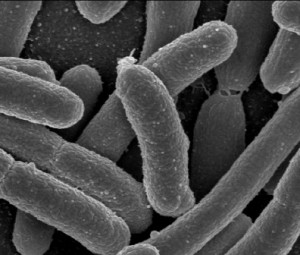 Probiotics reduce cholesterol Probiotics and LDL cholesterol