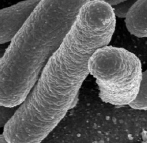 probiotics and IBS IBS and probiotics