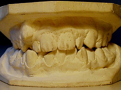 sensitive teeth ayurvedic remedies