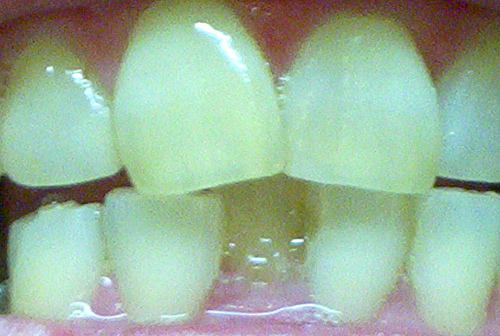 gums and chamomile